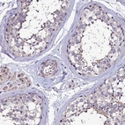 Immunohistochemical staining of human testis shows weak nuclear positivity in cells in seminiferous ducts with additional cytoplasmic positivity.