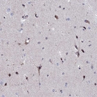 Immunohistochemical staining of human cerebral cortex shows moderate nuclear/cytoplasmic positivity in neuronal cells.