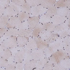 Immunohistochemical staining of human skeletal muscle shows moderate nuclear with additional weak cytoplasmic positivity in myocytes.