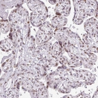 Immunohistochemical staining of human placenta shows moderate positivity in nuclear membrane in trophoblastic cells.