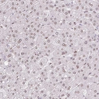 Immunohistochemical staining of human liver shows moderate positivity in nuclear membrane in hepatocytes.