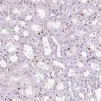Immunohistochemical staining of human kidney shows moderate nuclear positivity in subset of cells in tubules.