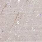 Immunohistochemical staining of human cerebral cortex shows weak cytoplasmic positivity in subset of neuronal cells.