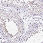 Immunohistochemical staining of human testis shows weak cytoplasmic positivity in subset of cells in seminiferous ducts.
