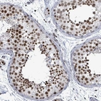 Immunohistochemical staining of human testis shows strong nuclear positivity in cells in seminiferous ducts.