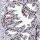 Immunohistochemical staining of human prostate shows moderate nuclear positivity in glandular cells.