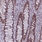 Immunohistochemical staining of human rectum moderate nuclear positivity in glandular cells.