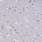 Immunohistochemical staining of human cerebral cortex shows moderate nuclear positivity in neuronal cells.