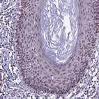 Immunohistochemical staining of human skin shows moderate nuclear positivity in squamous epithelial cells.