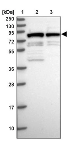 Lane 1: Marker [kDa] 250, 130, 95, 72, 55, 36, 28, 17, 10_br/_Lane 2: Human cell line RT-4_br/_Lane 3: Human cell line U-251MG sp