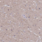 Immunohistochemical staining of human cerebral cortex shows moderate cytoplasmic positivity in neuropil.