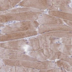 Immunohistochemical staining of human skeletal muscle shows moderate cytoplasmic positivity in myocytes.