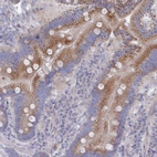 Immunohistochemical staining of human duodenum shows moderate cytoplasmic positivity in glandular cells.