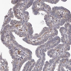 Immunohistochemical staining of human fallopian tube shows moderate positivity in leukocytes.