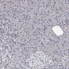 Immunohistochemical staining of human pancreas shows no positivity in exocrine glandular cells as expected.