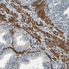 Immunohistochemical staining of human prostate shows strong cytoplasmic positivity in smooth muscle cells.