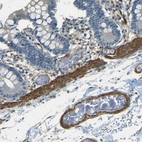 Immunohistochemical staining of human small intestine shows strong cytoplasmic positivity in smooth muscle cells.