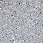 Immunohistochemical staining of human liver shows no cytoplasmic positivity in hepatocytes as expected.