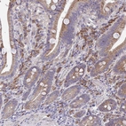 Immunohistochemical staining of human duodenum shows moderate cytoplasmic positivity in glandular cells and lymphoid cells.