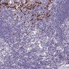 Immunohistochemical staining of human lymphoid tissues shows strong cytoplasmic-membranous positivity in subset of non-germinal center cells.