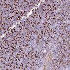 Immunohistochemical staining of human pancreas shows strong cytoplasmic positivity in exocrine glandular cells.