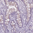Immunohistochemical staining of human small intestine shows weak cytoplasmic positivity in glandular cells.