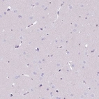 Immunohistochemical staining of human cerebral cortex shows no positivity in neuronal cells.