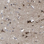 Immunohistochemical staining of human cerebral cortex shows strong cytoplasmic positivity in neuronal cells with additional cytoplasmic positivity in neuropil.
