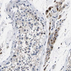Immunohistochemical staining of human testis shows strong cytoplasmic positivity in Leydig cells.