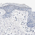 Immunohistochemical staining of human skin shows no positivity in squamous epithelial cells.