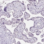 Immunohistochemical staining of human placenta shows no positivity in trophoblastic cells as expected.