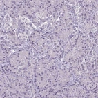 Immunohistochemical staining of human pancreas shows no positivity in exocrine glandular cells as expected.