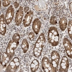 Immunohistochemical staining of human duodenum shows strong nuclear and cytoplasmic positivity in enteroendocrine cells and moderate in glandular cells.