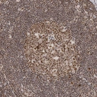 Immunohistochemical staining of human lymph node shows moderate nuclear and cytoplasmic positivity in germinal center cells.