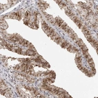 Immunohistochemical staining of human fallopian tube shows moderate nuclear and cytoplasmic positivity in glandular cells.