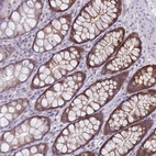 Immunohistochemical staining of human colon shows strong nuclear and cytoplasmic positivity in the crypt in glandular cells.