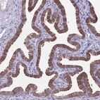 Immunohistochemical staining of human fallopian tube shows strong cytoplasmic positivity in glandular cells.