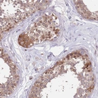 Immunohistochemical staining of human testis shows moderate nuclear and cytoplasmic positivity in cells in seminiferous ducts.