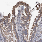 Immunohistochemical staining of human duodenum shows strong positivity in cytoplasm granular in glandular cells.