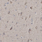 Immunohistochemical staining of human cerebral cortex shows moderate positivity in cytoplasm granular in neuronal cells and neuropil.