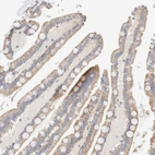 Immunohistochemical staining of human colon shows moderate cytoplasmic positivity in glandular cells.