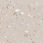 Immunohistochemical staining of human cerebral cortex shows moderate cytoplasmic positivity in neuronal cells with additional nucleoli expression.
