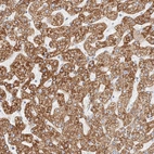 Immunohistochemical staining of human liver shows strong cytoplasmic positivity in hepatocytes.