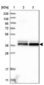 Lane 1: Marker [kDa] 230, 130, 95, 72, 56, 36, 28, 17, 11_br/_Lane 2: Human cell line RT-4_br/_Lane 3: Human cell line U-251MG sp