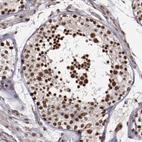 Immunohistochemical staining of human testis shows strong nuclear positivity in cells in seminiferous ducts.