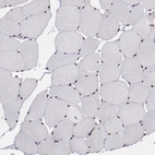 Immunohistochemical staining of human skeletal muscle shows strong nuclear positivity in myocytes.