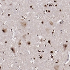 Immunohistochemical staining of human cerebral cortex shows strong nuclear positivity in neuronal cells.