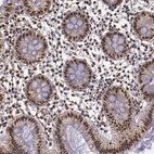 Immunohistochemical staining of human colon shows strong nuclear positivity in glandular cells.