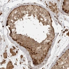 Immunohistochemical staining of human testis shows strong nuclear-cytoplasmic positivity in cells in seminiferous ducts and Leydig cells.