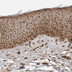 Immunohistochemical staining of human skin shows strong nuclear-cytoplasmic positivity in squamous epithelial cells.